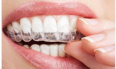 什么是牙齿正畸治疗(牙齿正畸治疗的定义)