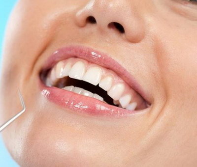 牙齿贴白膜能保持多久「牙齿树脂贴面保持多久」