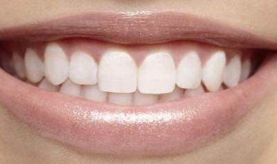 常见的牙齿畸形有哪些