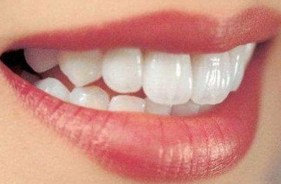 全瓷牙的危害和副作用(什么是全瓷牙？)