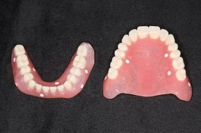 牙缝太大矫正牙齿需要多久(牙齿矫正需要拔4颗牙能收回牙缝吗)