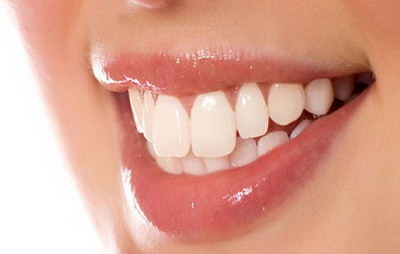 牙齿整形术的适应症状是哪些