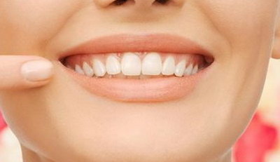 牙齿贴白膜能保持多久「牙齿树脂贴面保持多久」