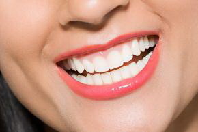 哺乳期牙齿发黑透明