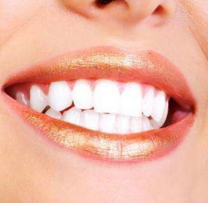 牙齿整形后有什么副作用吗「牙齿整形后有什么副作用」