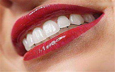 怎样去除牙齿上的黑色物质和牙黄「怎样去除牙齿上的黑色牙菌斑」
