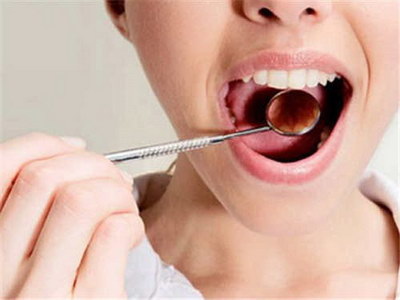 为什么洗牙后牙齿会发黄「为什么洗牙后牙齿不能献血」