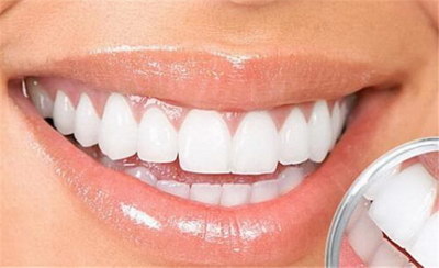 牙齿是怎么矫正的3d演示_牙齿往里凹怎么矫正