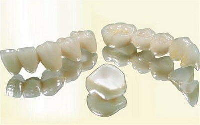 矫正牙齿要多长时间可以矫正_一般矫正牙齿多长时间可以戴牙套
