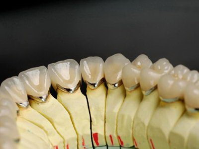 4岁小孩牙齿根管治疗疼不(小孩牙齿可以做根管治疗吗)