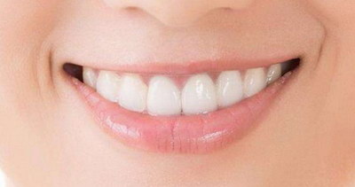 矫正器和牙套有什么区别(牙套和牙齿矫正器有什么区别)
