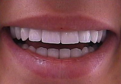 什么是牙龈出血的原因(尿血牙龈出血什么原因)