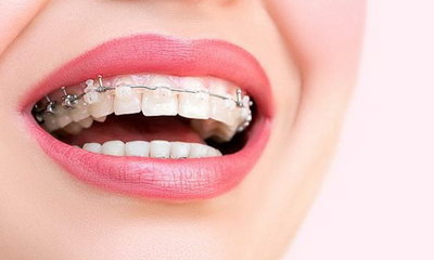 儿童乳牙门牙龋齿怎么办