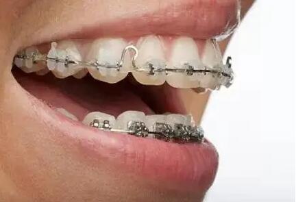 拔牙医保报销比例是多少
