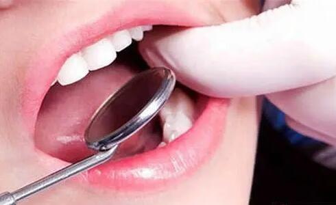 用什么方法可以使黄牙变白牙(用什么方法可以让黄牙变白)