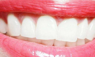 牙齿矫正危害有哪些_牙齿矫正会有哪些的危害
