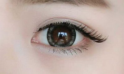 在广州割个双眼皮要多少钱_埋线法双眼皮手术费用