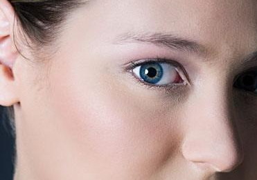 单眼皮如何变成双眼皮？