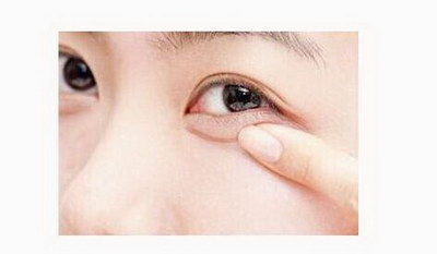 双眼皮割痕怎么修复
