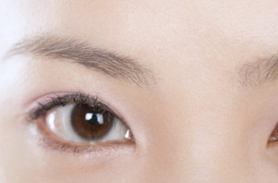 哪种类型的眼睛可以做埋线的双眼皮？