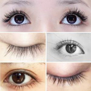 韩式双眼皮术如何成就完美眼部形态呢？