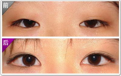 眼部肌底精华液和眼霜的区别【眼部精华液和眼霜有什么区别】