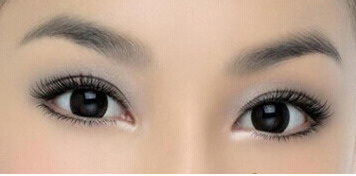 修复双眼皮能做眼综合吗