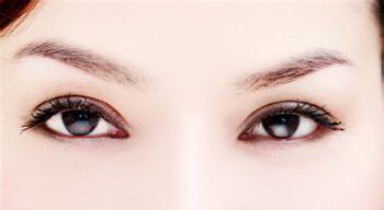 韩式双眼皮手术的几种分类