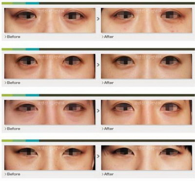 眼部肌底精华液和眼霜的区别【眼部精华液和眼霜有什么区别】