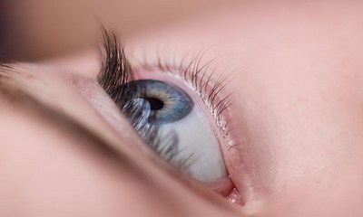 单眼皮埋线双眼皮手术的特点有哪些？
