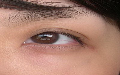 双眼皮遗传概率的题目