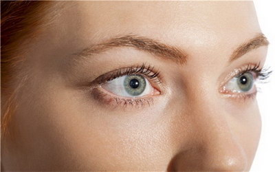 眼部脂肪过多导致单眼皮