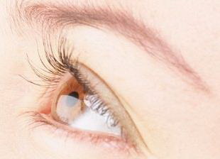 埋线双眼皮的13年历史:追求美的不断演化(埋线双眼皮技术历史)