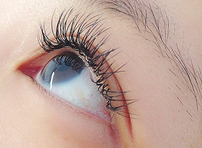 眼睛肿痒是什么原因用什么药水