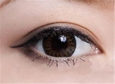 埋线双眼皮手术可以维持多久你知道吗？
