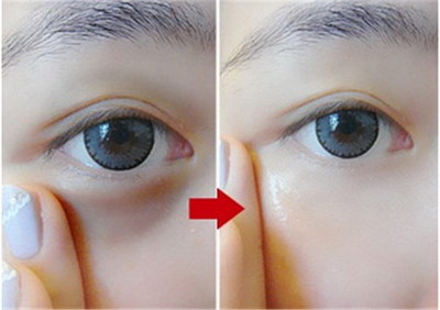 眼部扁平疣是怎么引起的,该怎么治疗「眼部扁平疣是怎么引起的该怎么治疗」