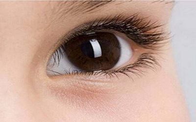 为什么一个单眼皮一个双眼皮基因