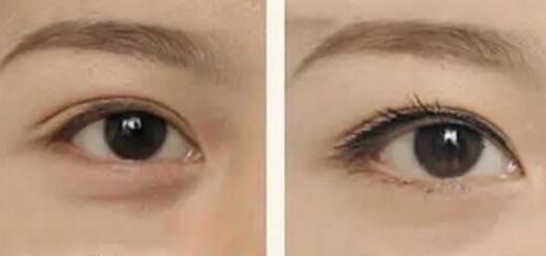 淡化黑眼圈的眼霜排行(平价淡化黑眼圈的眼霜)