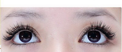 韩式做双眼皮手术有哪些注意事项？