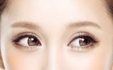 三点式双眼皮适合人群「韩式三点式双眼皮适合人群」