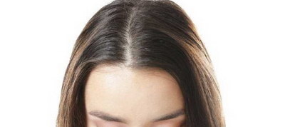 发际线毛发密度