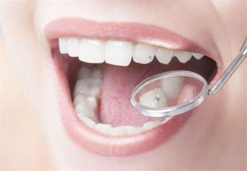 2023年蚌埠市国产华西CDIC种植牙体整形医院你知道哪几个