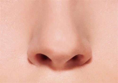 膨体隆鼻歪斜和自己的鼻基础有关系吗