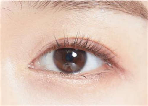 驻马店市汝南县内双眼皮成形医生排名榜七强技术亮眼